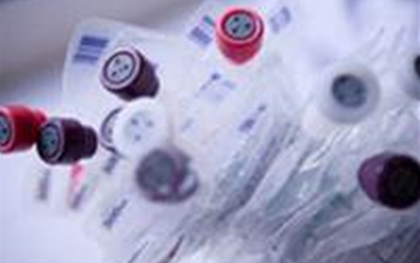 塑料粘结前等离子表面处理 塑料粘结前等离子表面处理